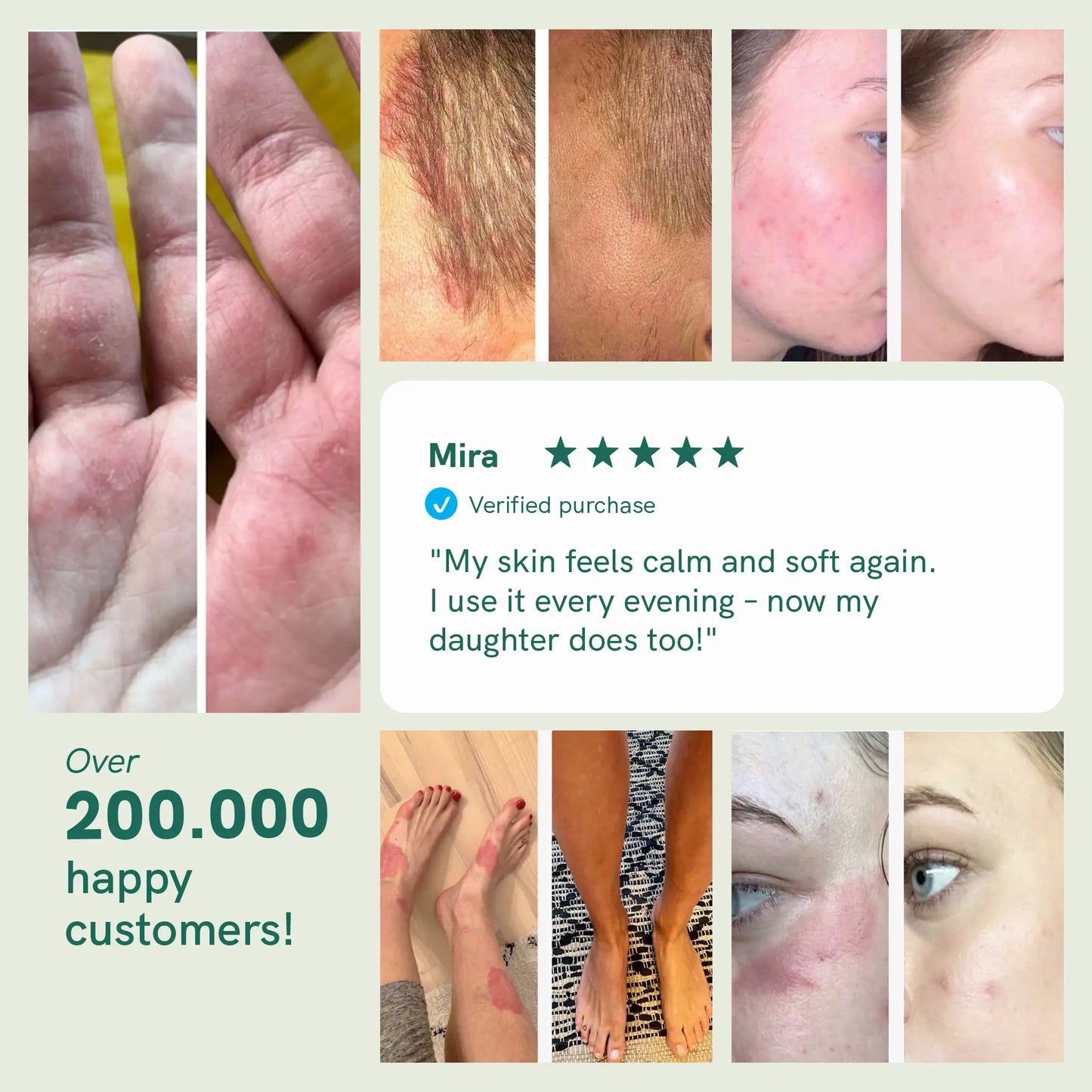 3FOR2: CBD Cream