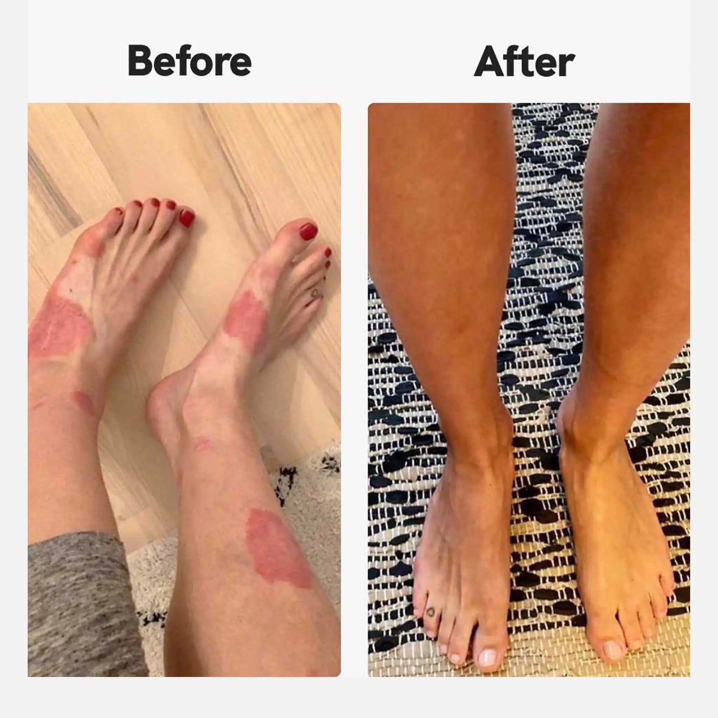 Results from customers using Nordic Oil's cbd cream for psoriasis