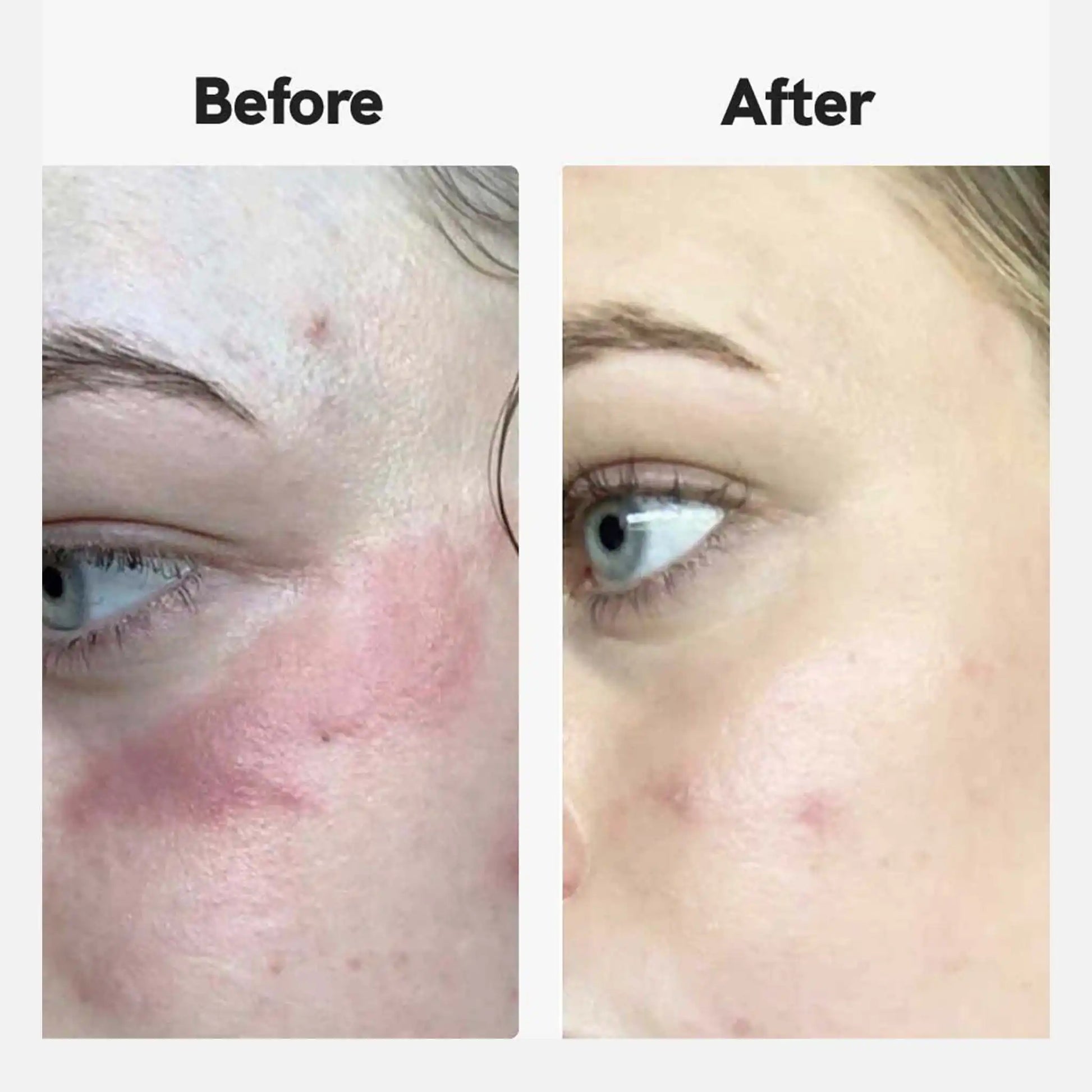 Results from customers using Nordic Oil's cbd eczema cream